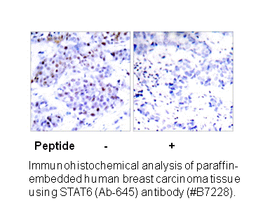 Product image for STAT6 (Ab-645) Antibody