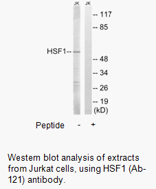 Product image for HSF1 (Ab-121) Antibody