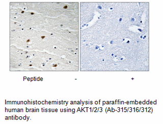 Product image for AKT1/2/3 (Ab-315/316/312) Antibody