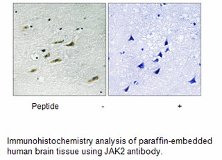 Product image for JAK2 (Ab-931) Antibody