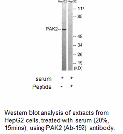 Product image for PAK2 (Ab-192) Antibody