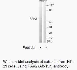 Product image for PAK2 (Ab-197) Antibody