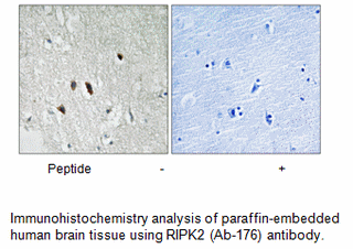 Product image for RIPK2 (Ab-176) Antibody