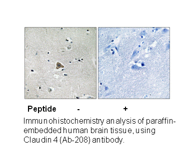 Product image for Claudin 4 (Ab-208) Antibody