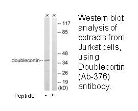 Product image for Doublecortin (Ab-376) Antibody
