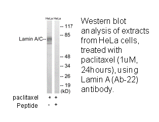 Product image for Lamin A (Ab-22) Antibody