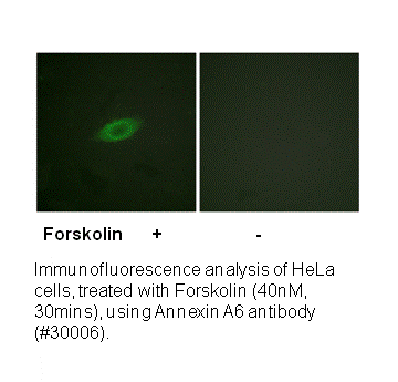 Product image for Annexin A6 Antibody