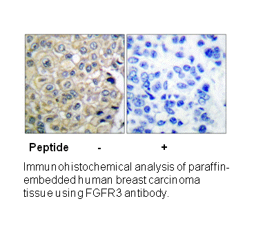 Product image for FGFR3 Antibody