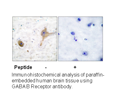 Product image for GABA-B Receptor Antibody