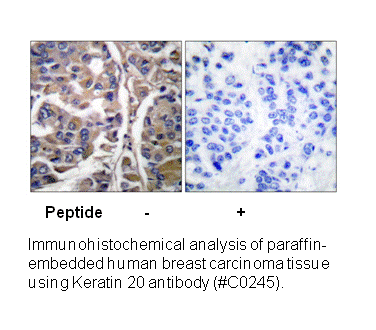 Product image for Keratin 20 Antibody
