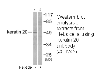 Product image for Keratin 20 Antibody