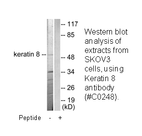 Product image for Keratin 8 Antibody