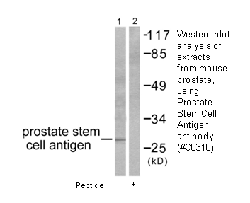 Product image for Prostate Stem Cell Antigen Antibody
