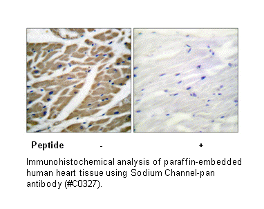 Product image for Sodium Channel-pan Antibody