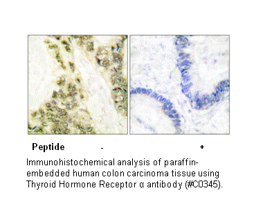 Product image for Thyroid Hormone Receptor &alpha; Antibody