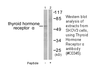 Product image for Thyroid Hormone Receptor &alpha; Antibody