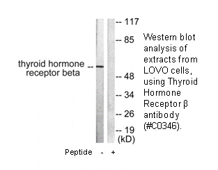 Product image for Thyroid Hormone Receptor &beta; Antibody