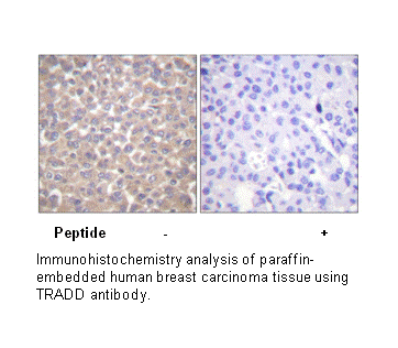 Product image for TRADD Antibody
