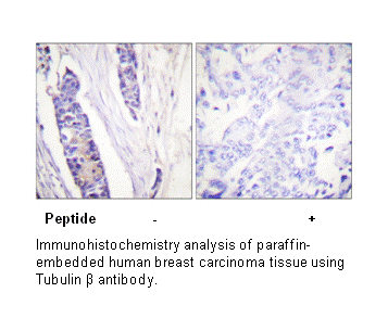 Product image for Tubulin &beta; Antibody