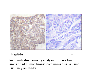 Product image for Tubulin &gamma; Antibody