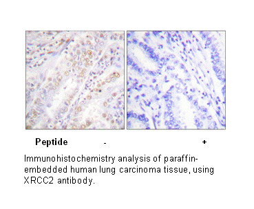 Product image for XRCC2 Antibody