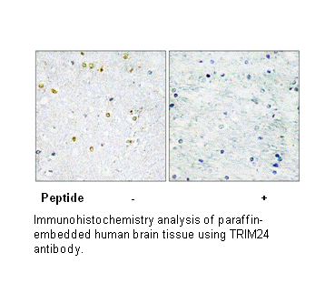 Product image for TRIM24 Antibody