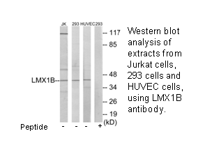 Product image for LMX1B Antibody