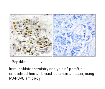 Product image for MAP3K6 Antibody