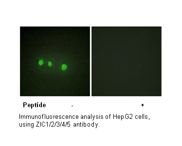 Product image for ZIC1/2/3/4/5 Antibody