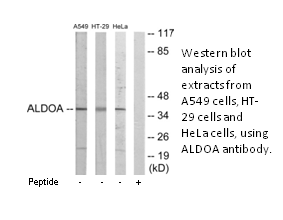 Product image for ALDOA Antibody