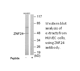 Product image for ZNF24 Antibody