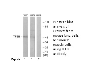 Product image for TFEB Antibody