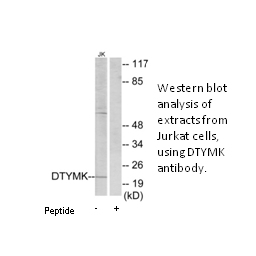 Product image for DTYMK Antibody