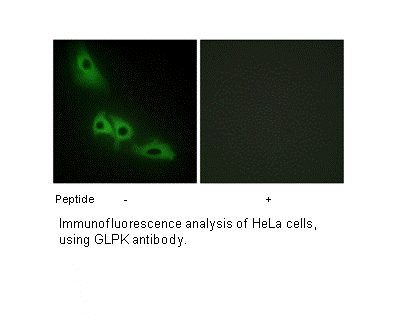 Product image for GLPK Antibody