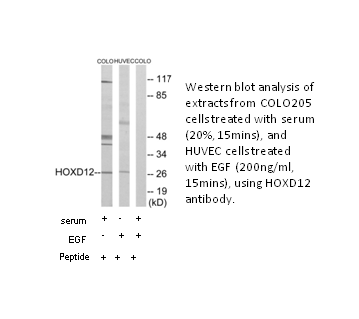 Product image for HOXD12 Antibody