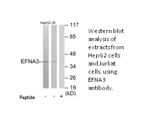 Product image for EFNA3 Antibody