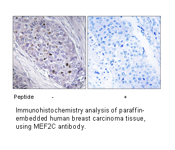 Product image for MEF2C Antibody