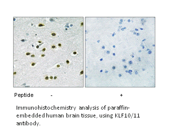Product image for KLF10/11 Antibody