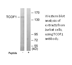 Product image for TCOF1 Antibody