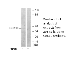Product image for CDK10 Antibody