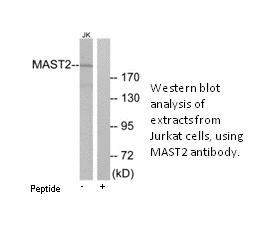 Product image for MAST2 Antibody