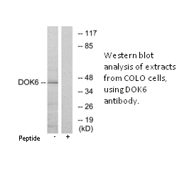 Product image for DOK6 Antibody