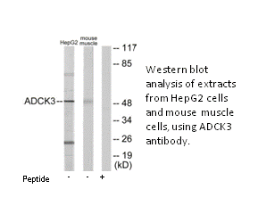 Product image for ADCK3 Antibody