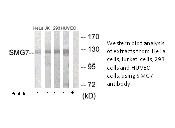 Product image for SMG7 Antibody