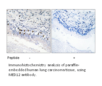 Product image for MED12 Antibody