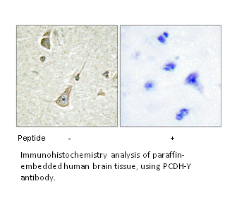 Product image for PCDH-Y Antibody