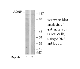 Product image for ADNP Antibody