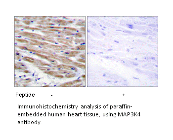 Product image for MAP3K4 Antibody