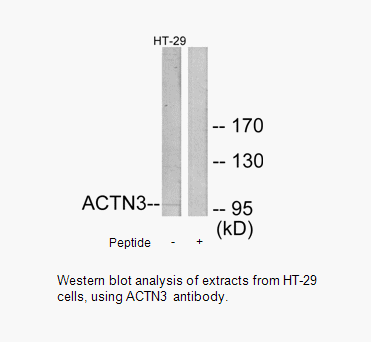 Product image for ACTN3 Antibody