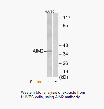 Product image for AIM2 Antibody